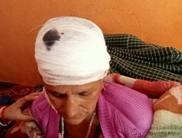 Tehri News: टिहरी में नहीं थम रहा जंगली जानवरों का आतंक, दिन-दहाड़े बुजुर्ग महिला पर गुलदार ने किया हमला।